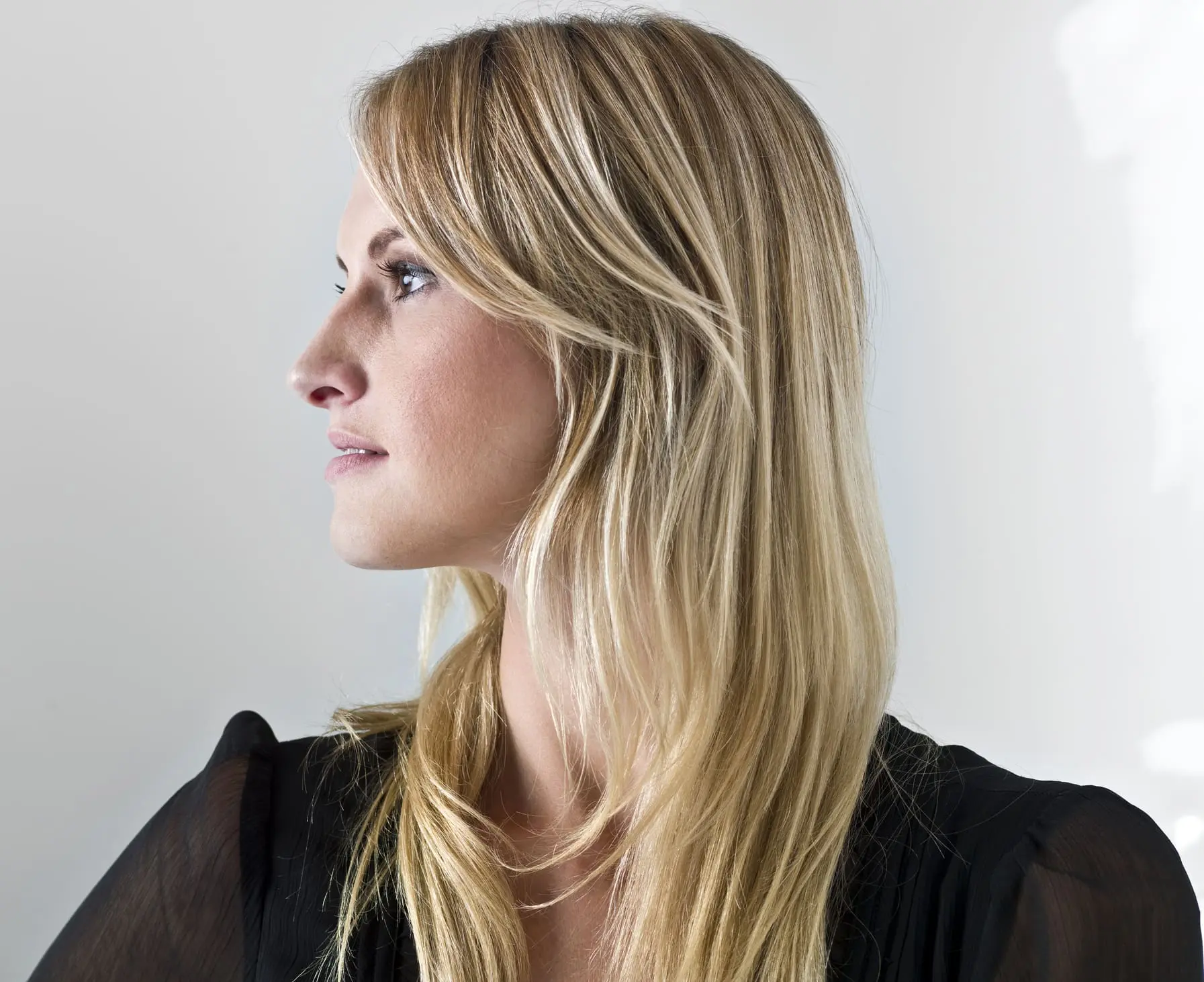 Beautiful caucasian woman profile Juvederm Volux XC in Charleston County, SC