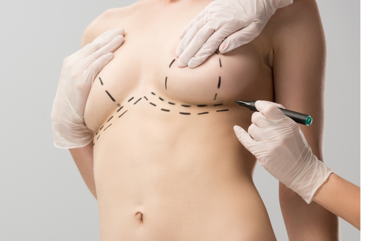 cropped-view-of-plastic-surgeon-in-latex-gloves-ma-2023-11-27-05-01-40-utc Breast Implant Removal in Charleston County, SC