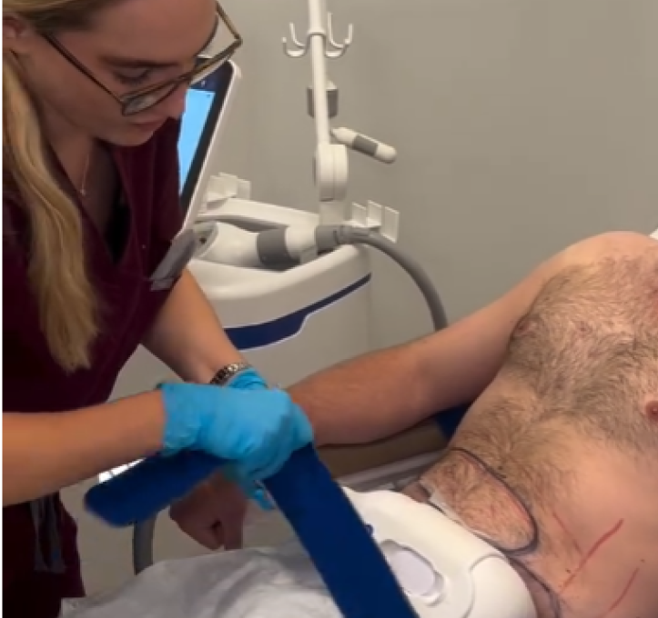image (2) CoolSculpting® in Charleston County, SC