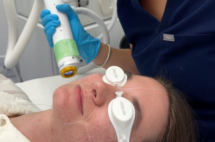 image (10) Laser Skin Resurfacing in Charleston County, SC