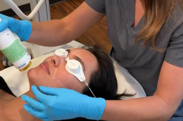 image (9) Laser Skin Resurfacing in Charleston County, SC
