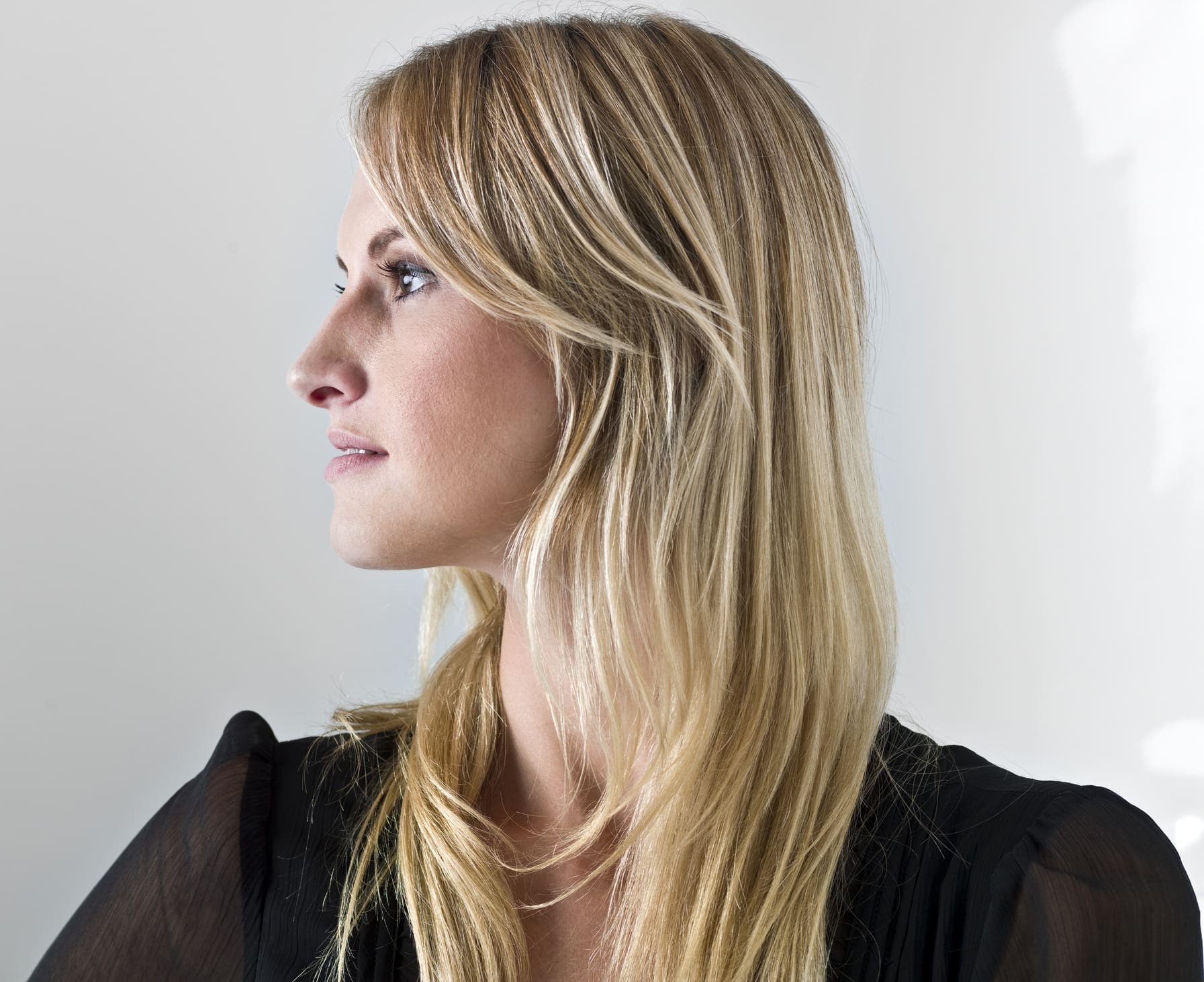 Beautiful caucasian woman profile Juvederm Volux XC in Charleston County, SC