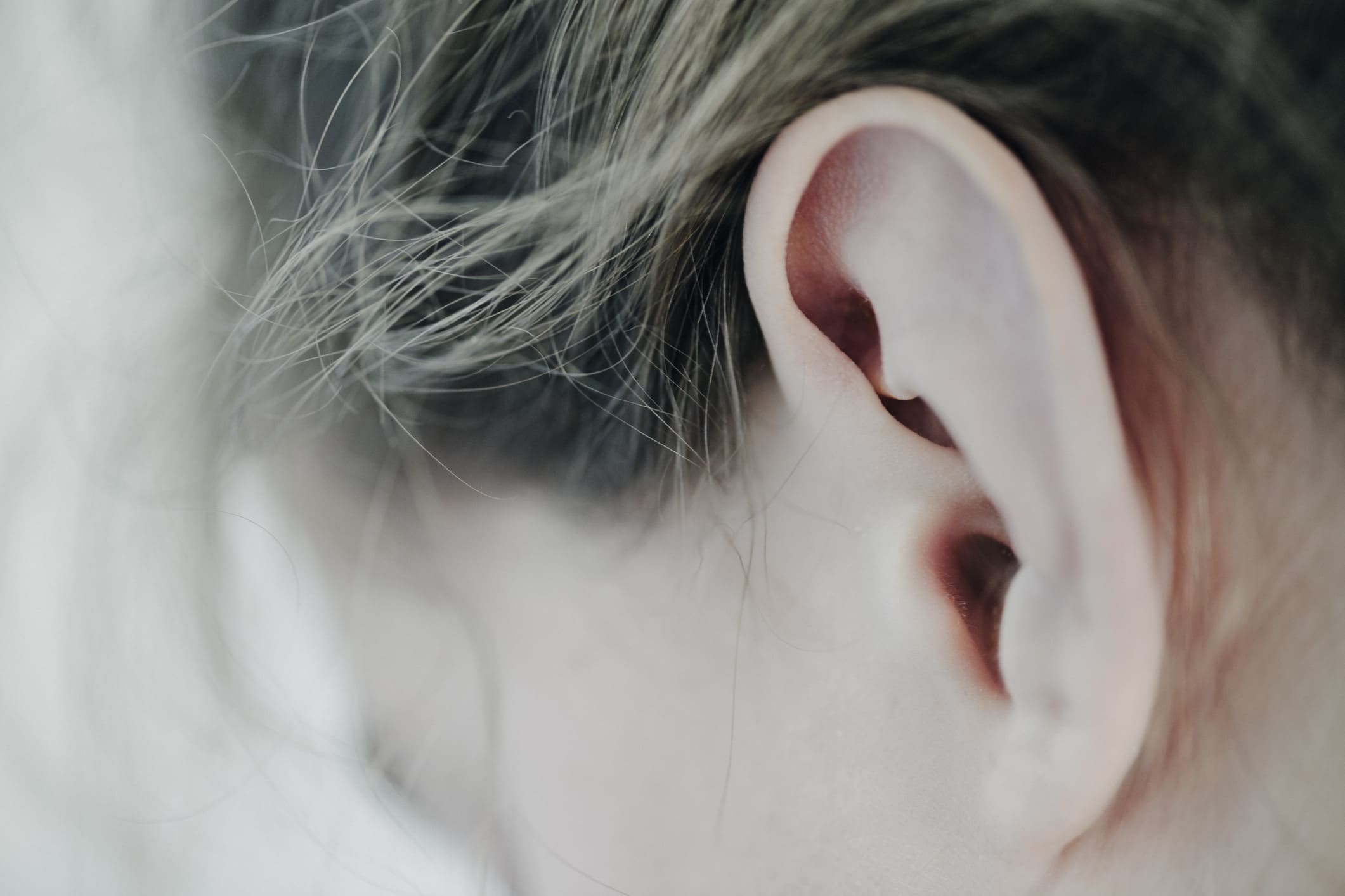 Close-Up of The Ear of a Young Girl. Hair Restoration in Charleston County, SC