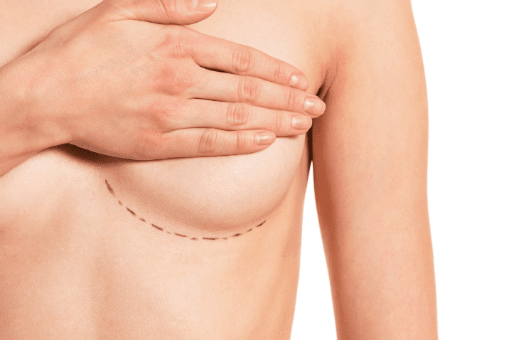 preparation-for-breast-surgery-2023-11-27-05-09-36-utc Breast Enhancement in Charleston County, SC