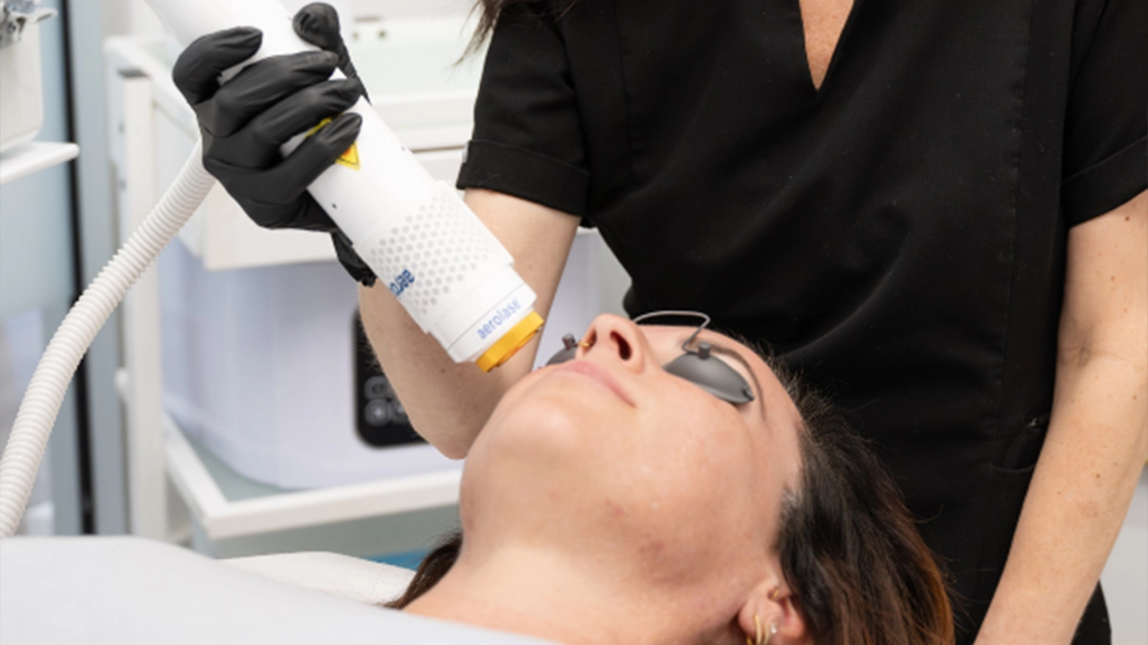 Laser Treatments
in Charleston, SC