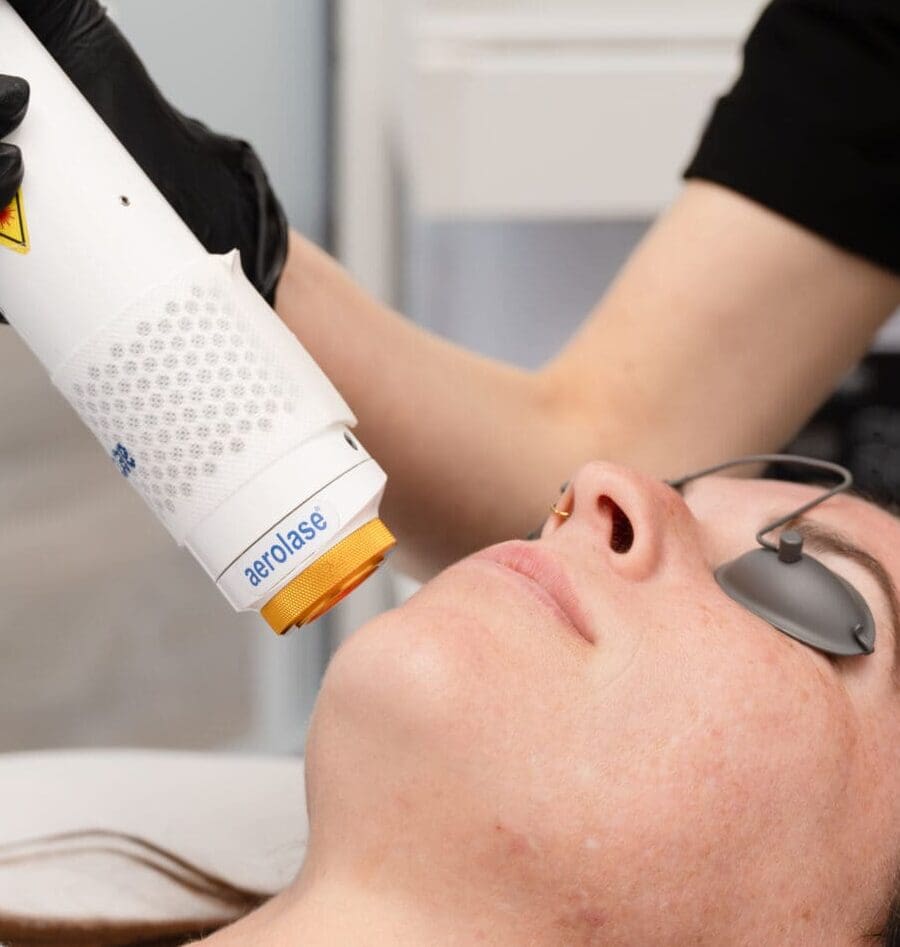 Aerolase Laser in Charleston County, SC