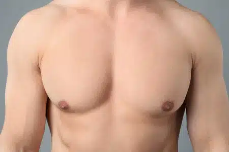 big-young-man-with-smooth-chest-after-epilation-proced-2026-03-17-14-47-19-utc