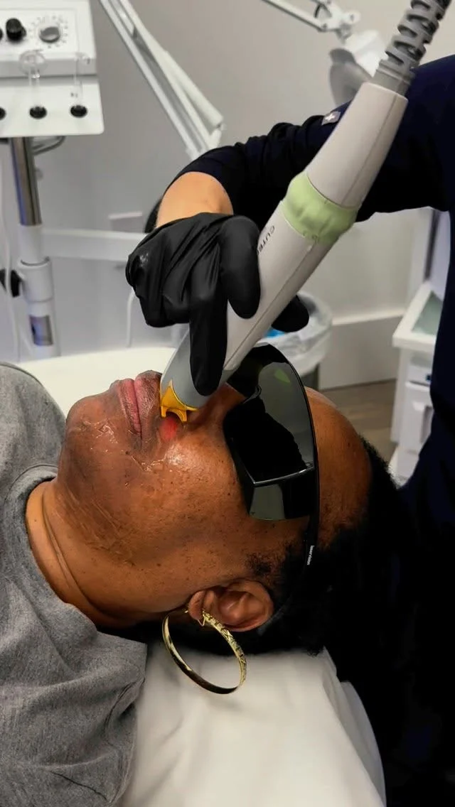 ✨ Meet XEO — the all-in-one laser platform that’s changing the skincare game XEO treats a wide range of skin concerns using customizable laser and light-based technology. Whether you’re battling:
✅ Sun damage & age spots
✅ Redness & rosacea
✅ Fine lines & texture
✅ Unwanted hair XEO adapts to your skin’s unique needs with non-invasive precision. 💬 Want to know if XEO is right for you? Let’s chat! 📅 Book your consultation today and let’s get going! 📩 use the link 🔗 in bio📞 (843) 264-7973! Nexton📍218 Brighton Park Blvd, Suite 102,Summerville, SC 29486 Daniel Island📍20 Fairchild Street, Suite 102, Charleston, SC, 29492 West Ashley📍1930 Charlie Hall Boulevard, Charleston, SC 29414 #CharlestonSkinCare #charlestonmedspa #xeatreatment #charlestonplasticsurgery #skincare